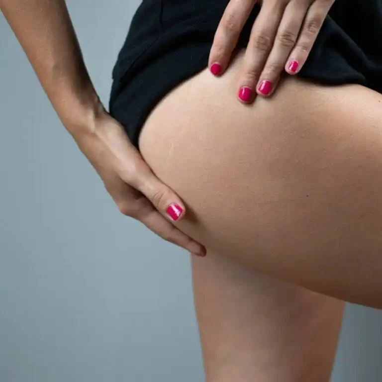 Ανόρθωση-Μηρών