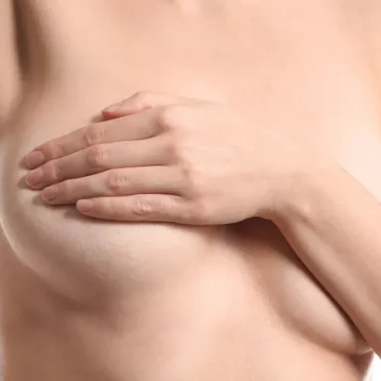 Συγγενείς-Ανωμαλίες-Μαστών